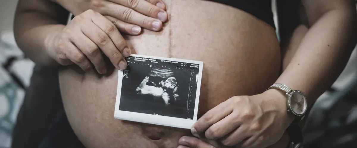 5 bonnes raisons de garder surprise le sexe de bébé